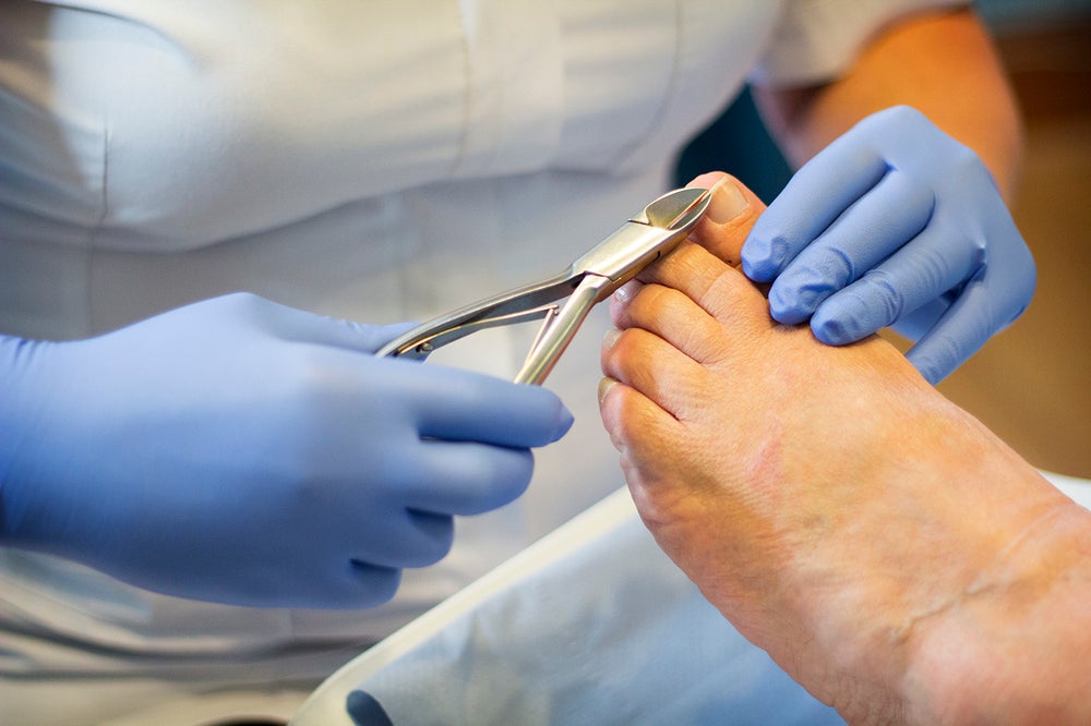 Ingrown Toenails - Greater Houston Foot & Ankle Specialists